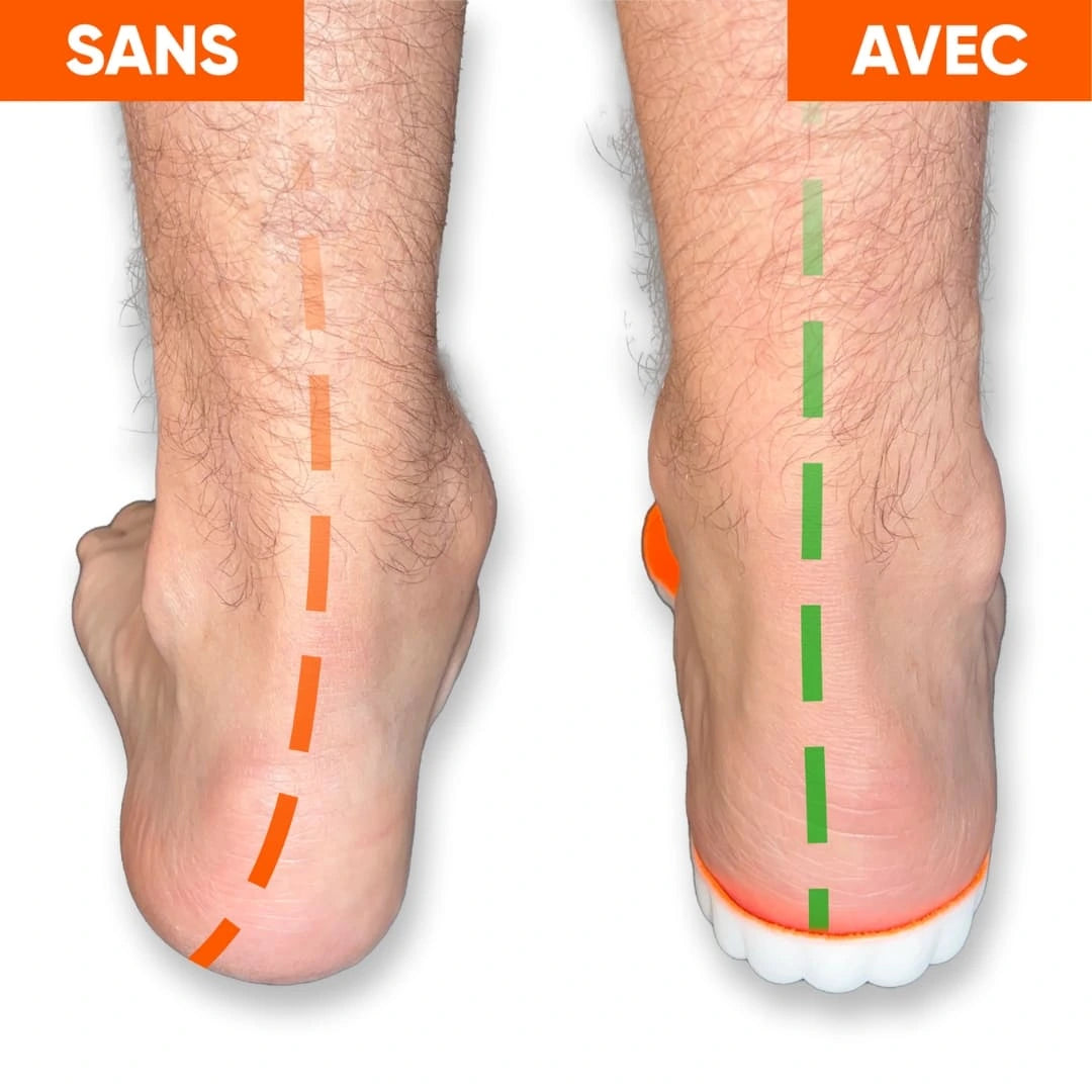 Skum Confort® - Semelles Massantes